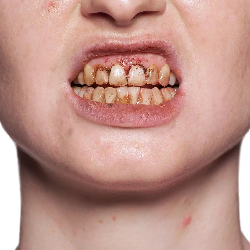Tooth Enamel Red