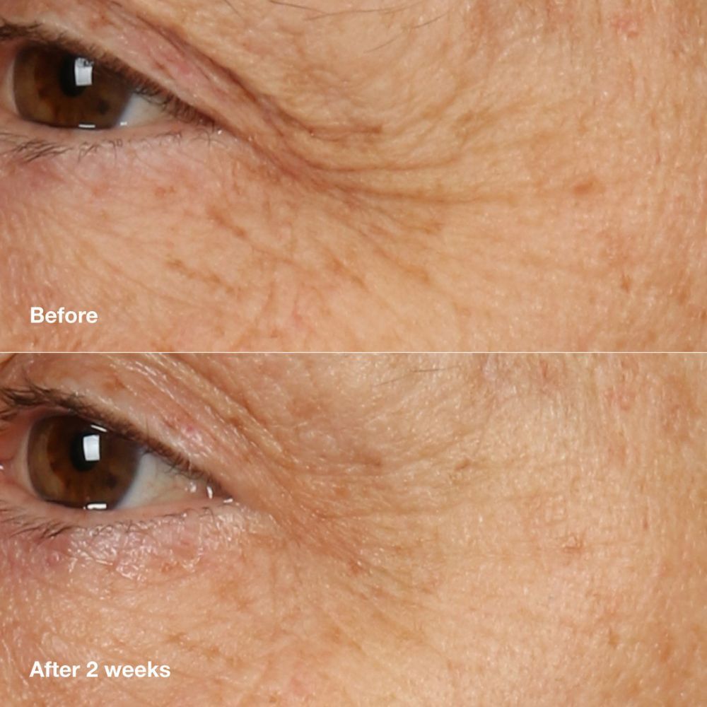 Clinique Smart Clinical Repair™ Overnight Recovery Cream + Mask