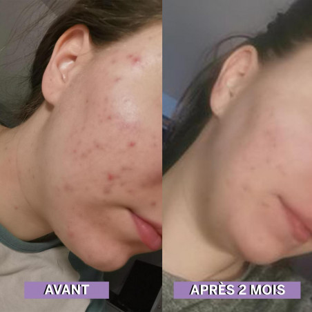 Birdie Nutrition Skin Cleaner 3 mois