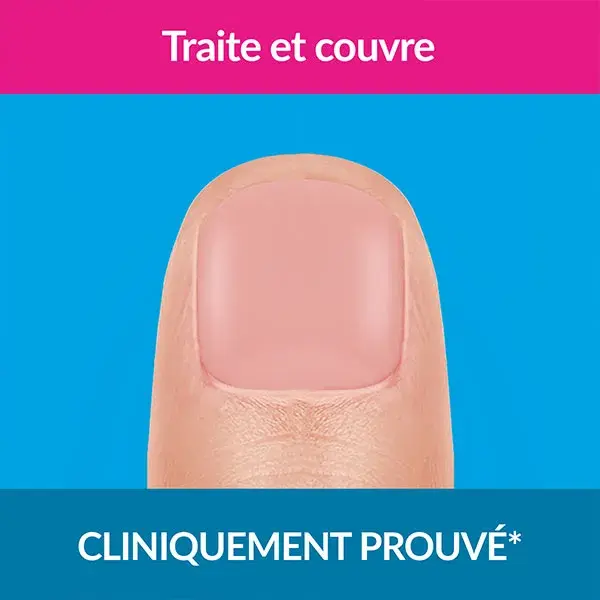 Excilor Solution Forte Color Traitement Mycose de l'Ongle