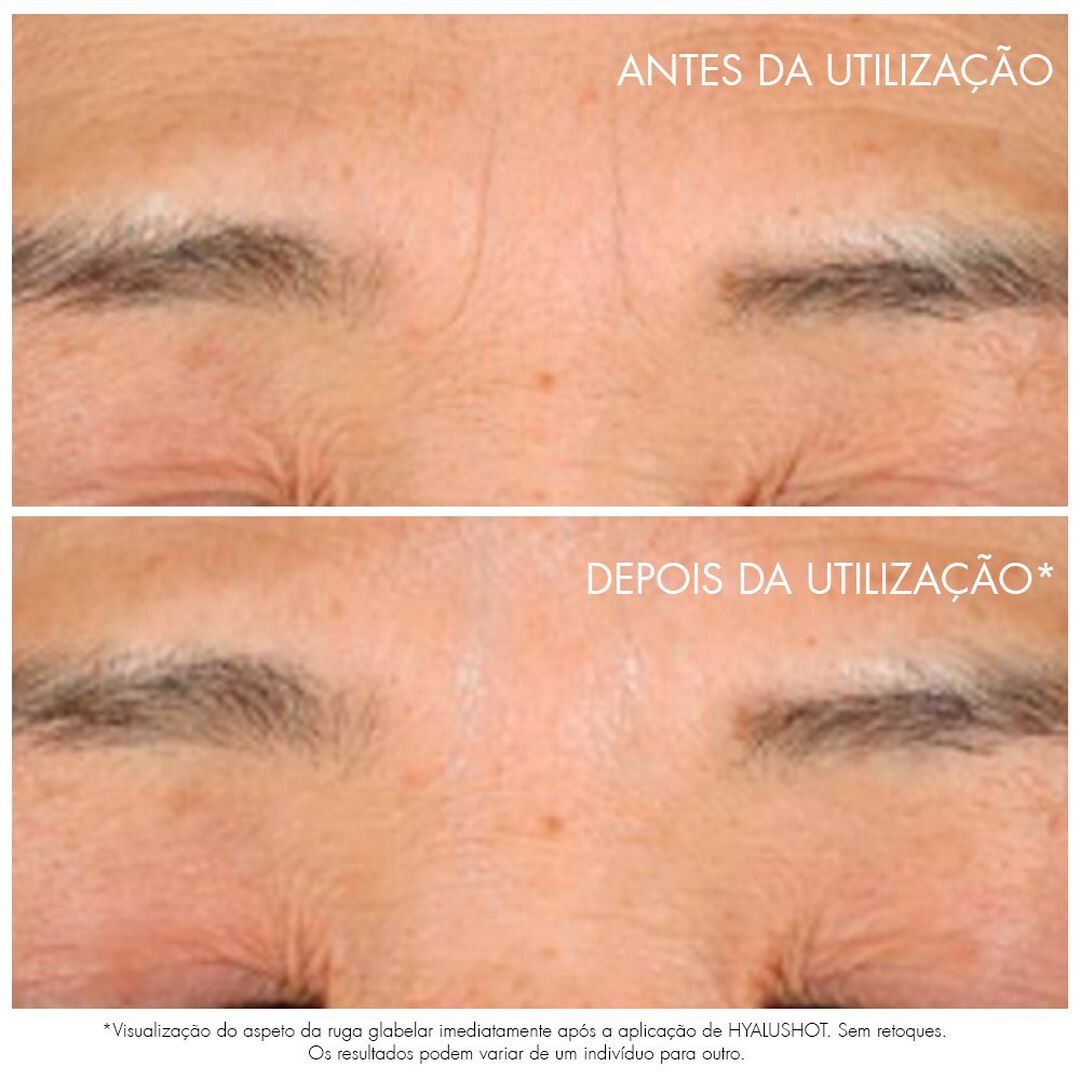 Dior Capture Totale Hyalushot - 15ml
