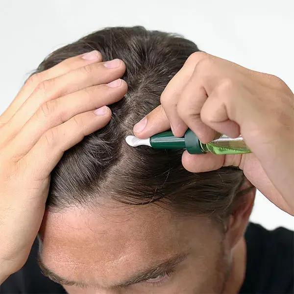 Protocolo Trifásico de René Furterer para Queda de Cabelo Progressiva