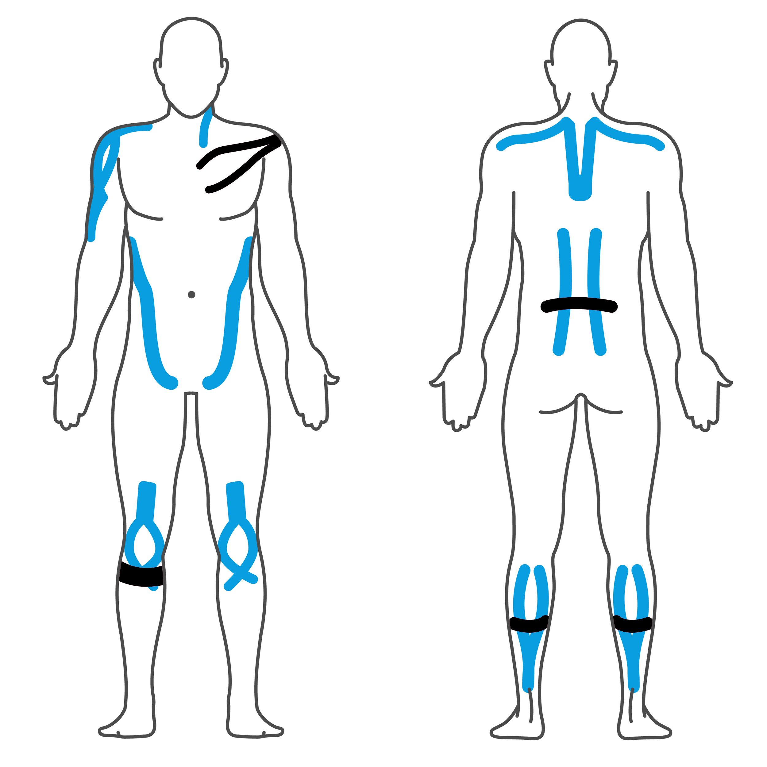 Effekt Manufaktur Kinesiologie Tape – 500 x 5 cm – in schwarz und blau