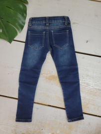 Zipped & distressed jeans