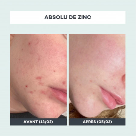 D-LAB NUTRICOSMETICS Absolu de Zinc 3 mois