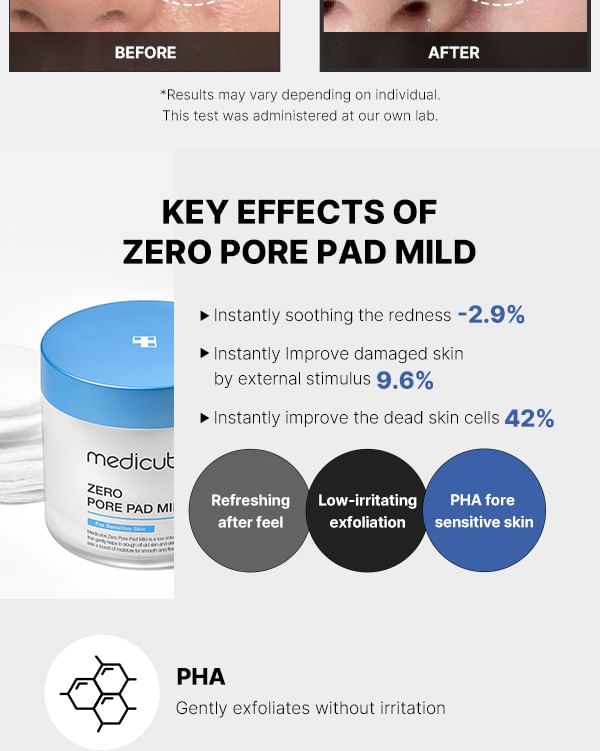medicube - Zero Pore Pad Mild