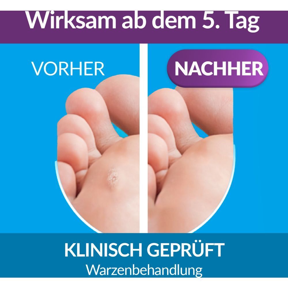 excilor® 2in1 GEGEN WARZEN
