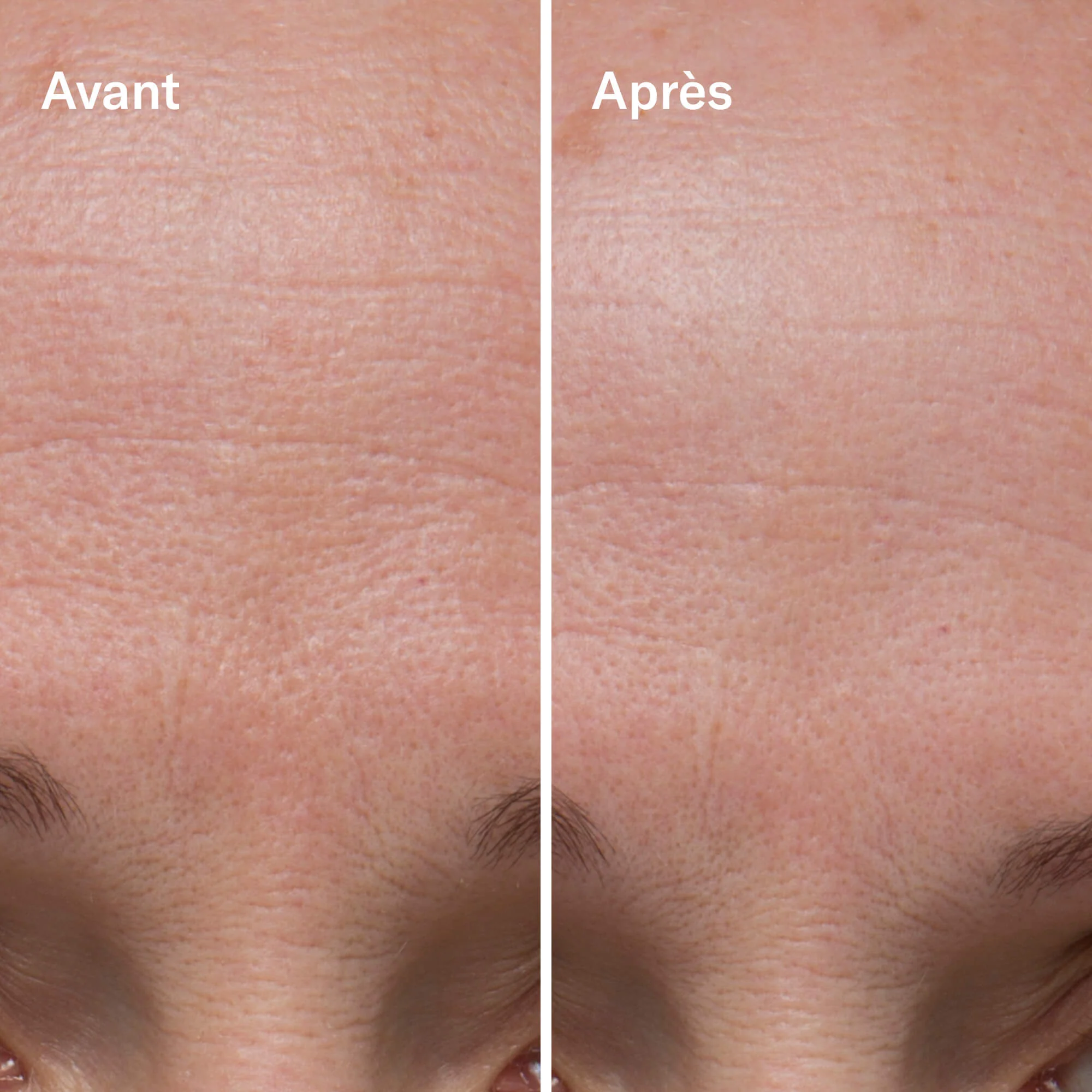 Odacité Clean-ical Renewing Serum Sérum Rénovant