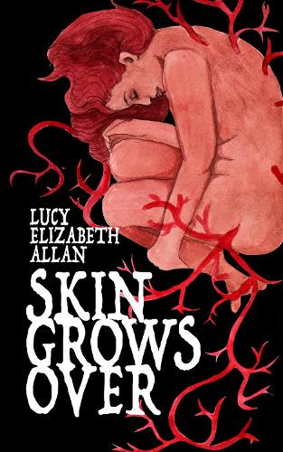 Skin Grows Over (Paperback)