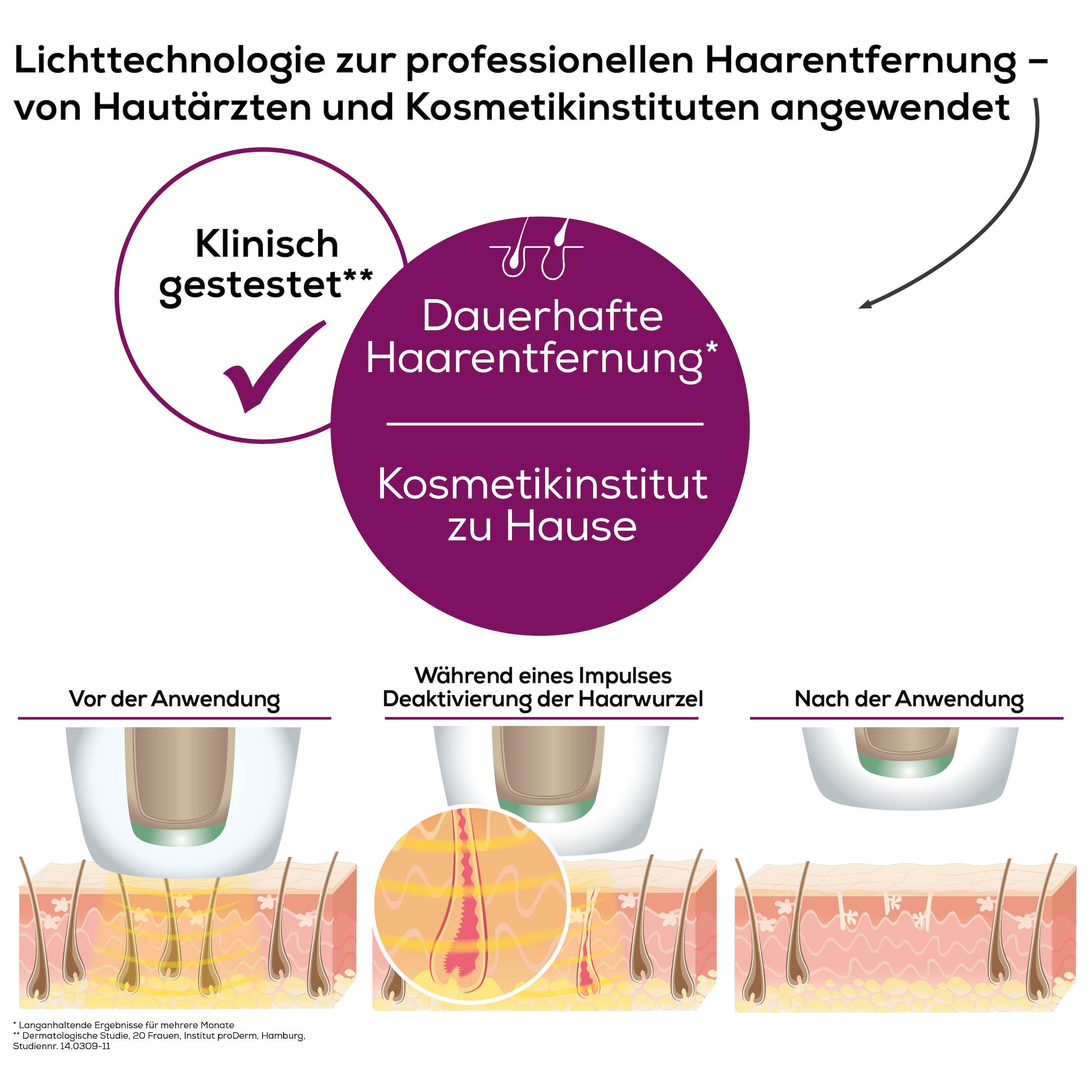 BEURER IPL-Haarentferner »IPL 8500 für langanhaltende Haarentfernung durch Lichttechnologie« 300000 Lichtimpulse Kraftvolles Akkugerät für eine flexible, kabellose Anwendung