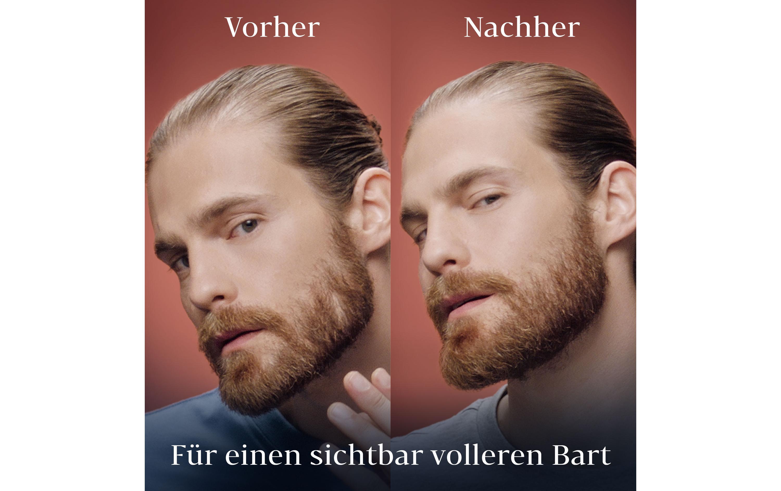 Bartvolumen Serum 50 mlBartvolumen-Serum, mit Vitamin-B-Komplex und Koffein formuliert