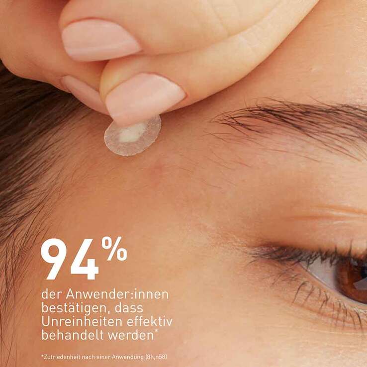 CeraVe Anti-Unreinheiten Patches, 22 St