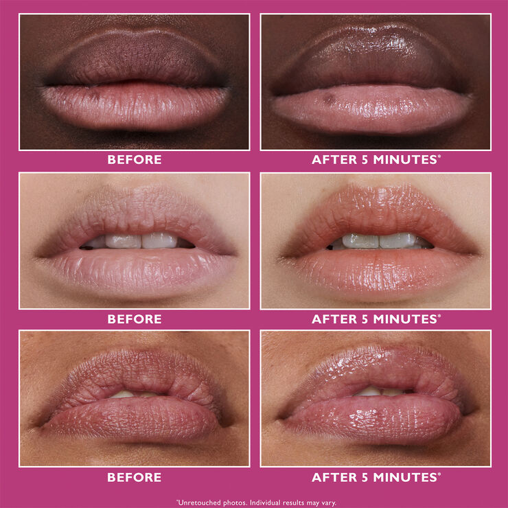Peter Thomas Roth Peter Thomas Roth Instant FIRMx® Lip Filler 10 ml