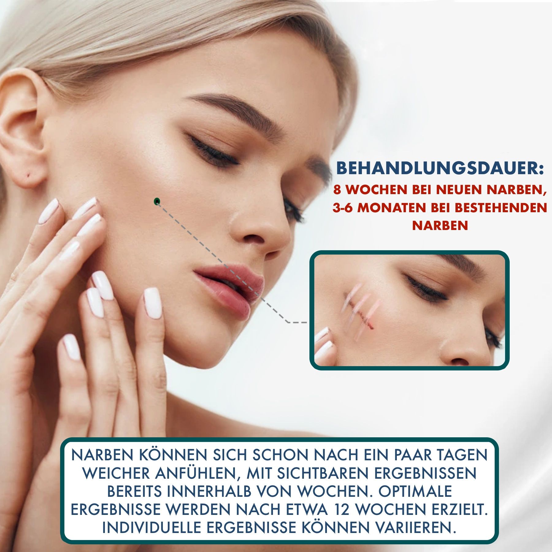 P-Beauty Wundpflaster für Narben