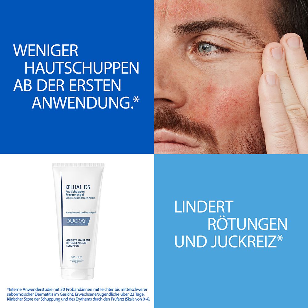 DUCRAY KELUAL DS Anti-Schuppen Reinigungsgel