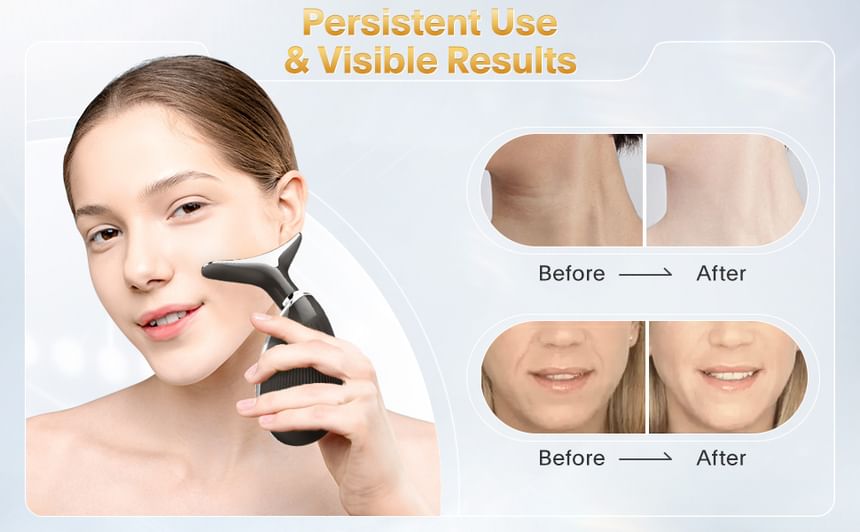 Beautyronics - USB oplaadbaar facelift-apparaat (verschillende ontwerpen)