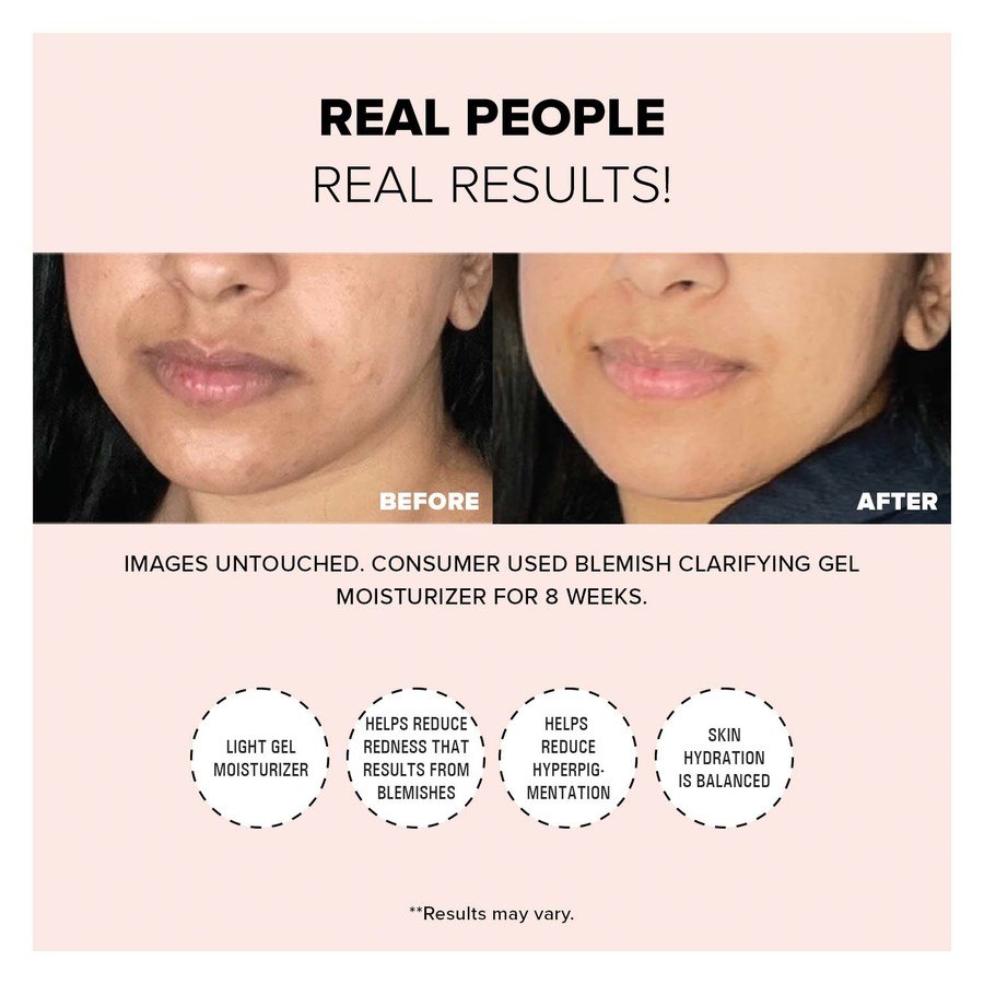 Nudestix Nudeskin Blemish Clarifying Gel Moisturizer 60ml
