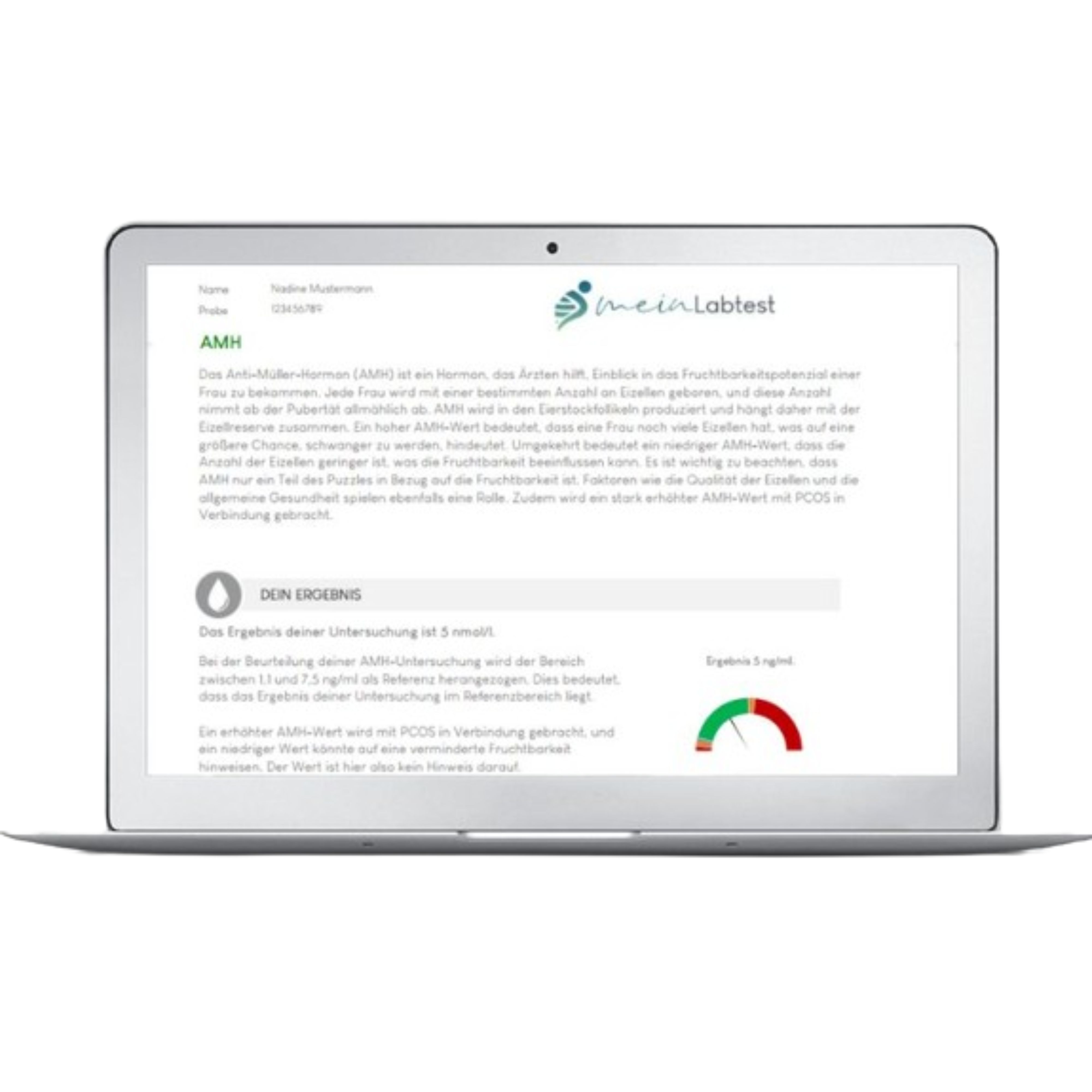 Meinlabtest AMH Test