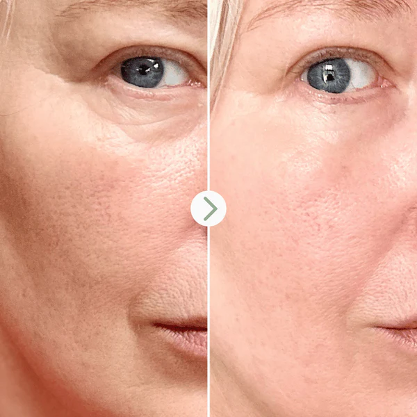 Pai skincare Booster Rénovateur de Peau au Rétinal 10ml
