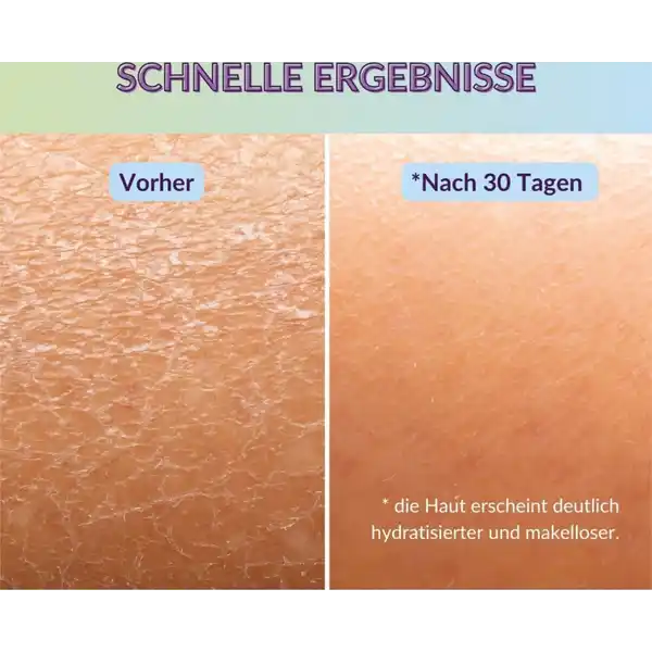 Hyaluronic Facial Gel