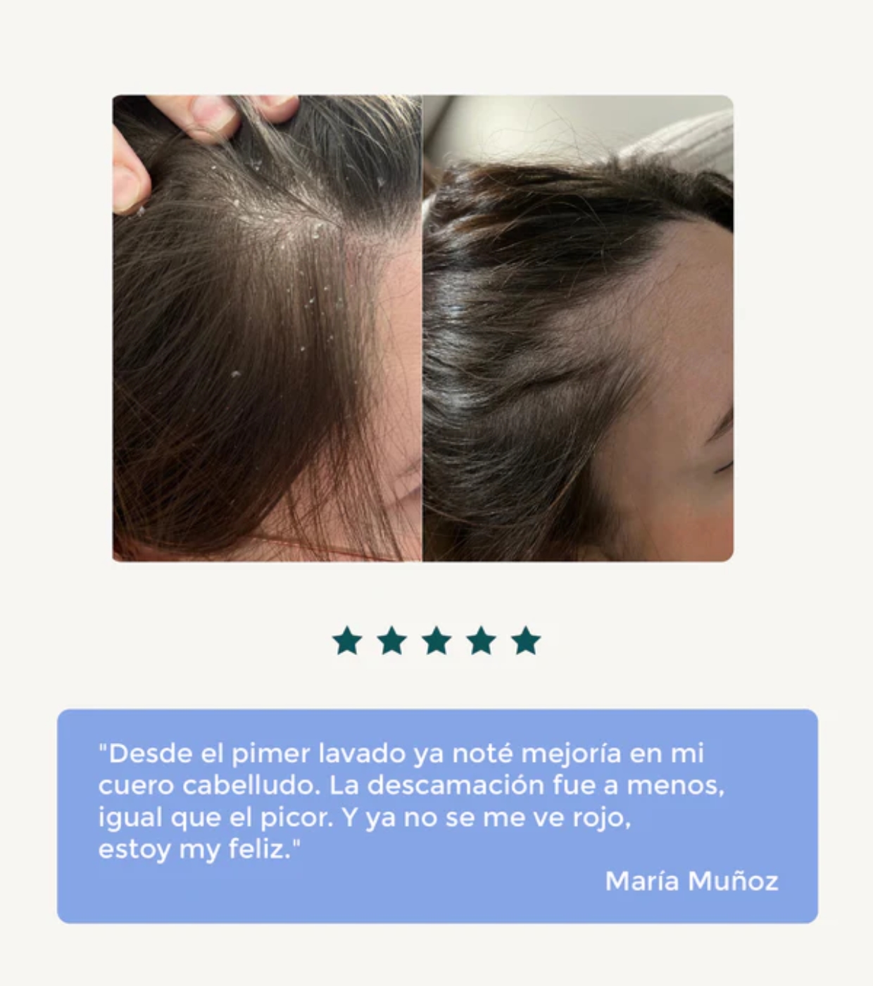 Green Cornerss - Shampoo de Ervilha - Couro Cabeludo Sensível