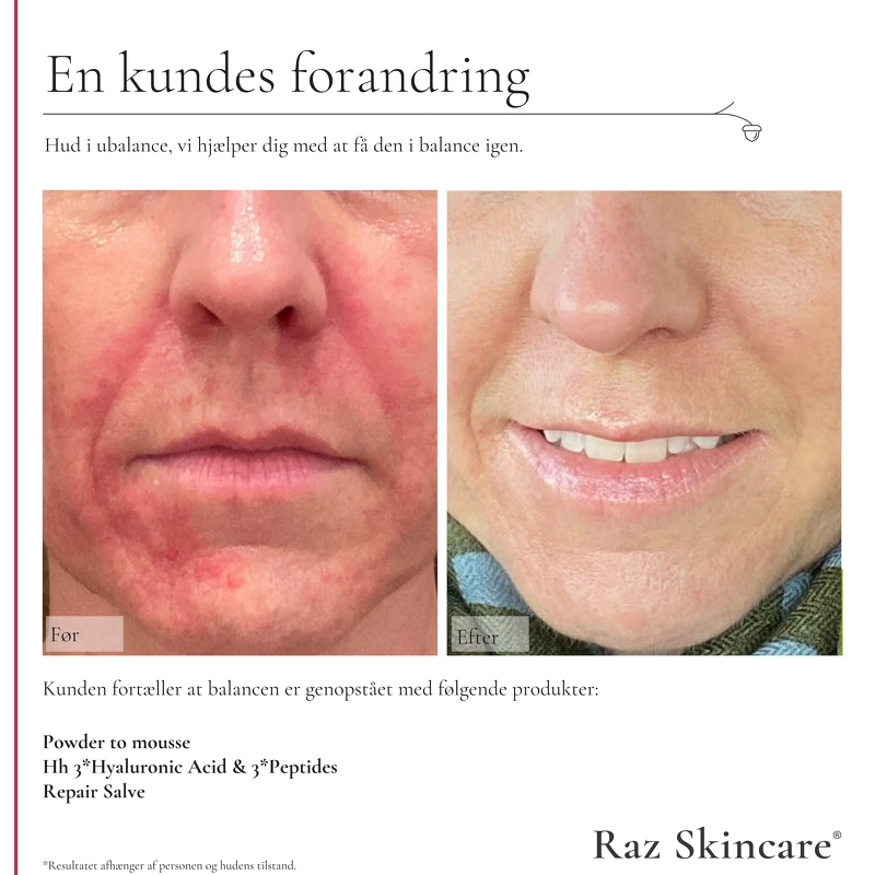 Raz Skincare Hh 3 x Hyaluronic Acid & 3 x Peptides 30 ml