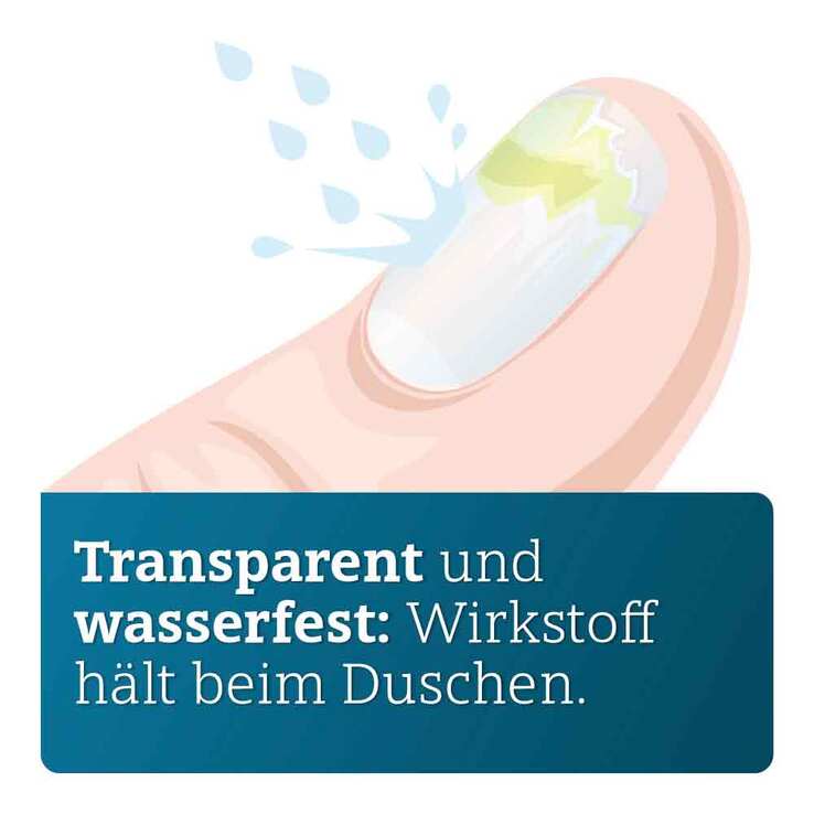 Amorolfin ADGC 50 mg / ml wirkstoffhalt.Nagellack, 5 ml