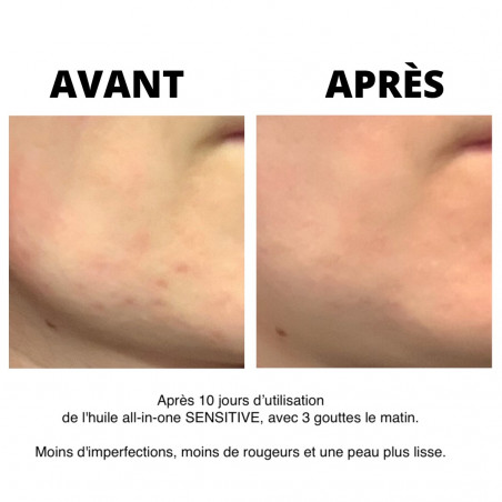 Les huilettes Huile All-in-One Sensitive