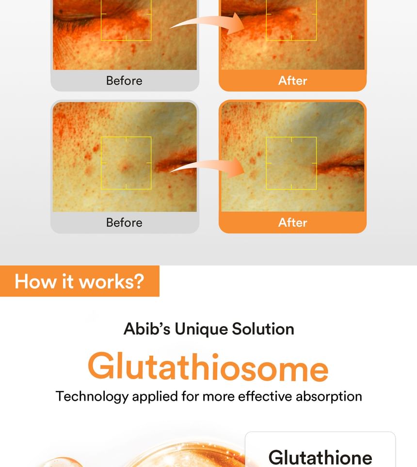 Abib - Glutathiosome Donkere Vlekken Serum Vita Druppel