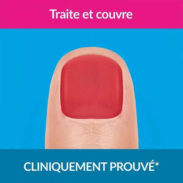 Excilor Strong Tratamento para Micose de Unhas Cor Vermelho Coral