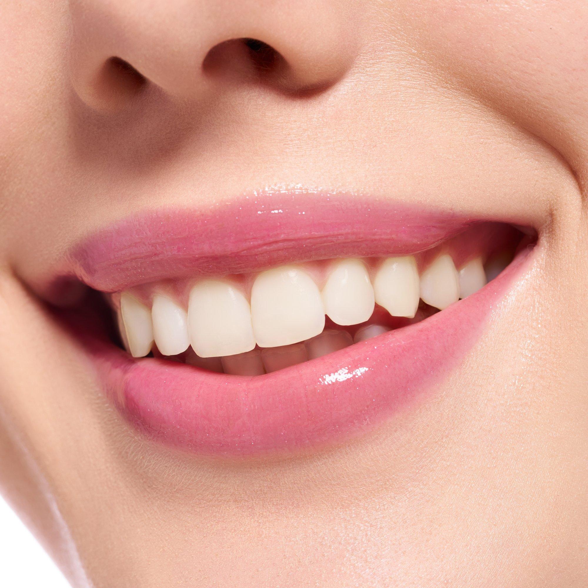 extreme shine volume lipgloss