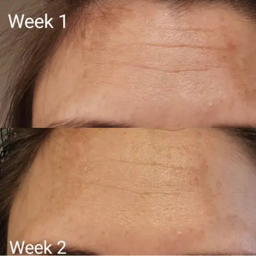 Hydrolyzed Collagen & Vitamin C