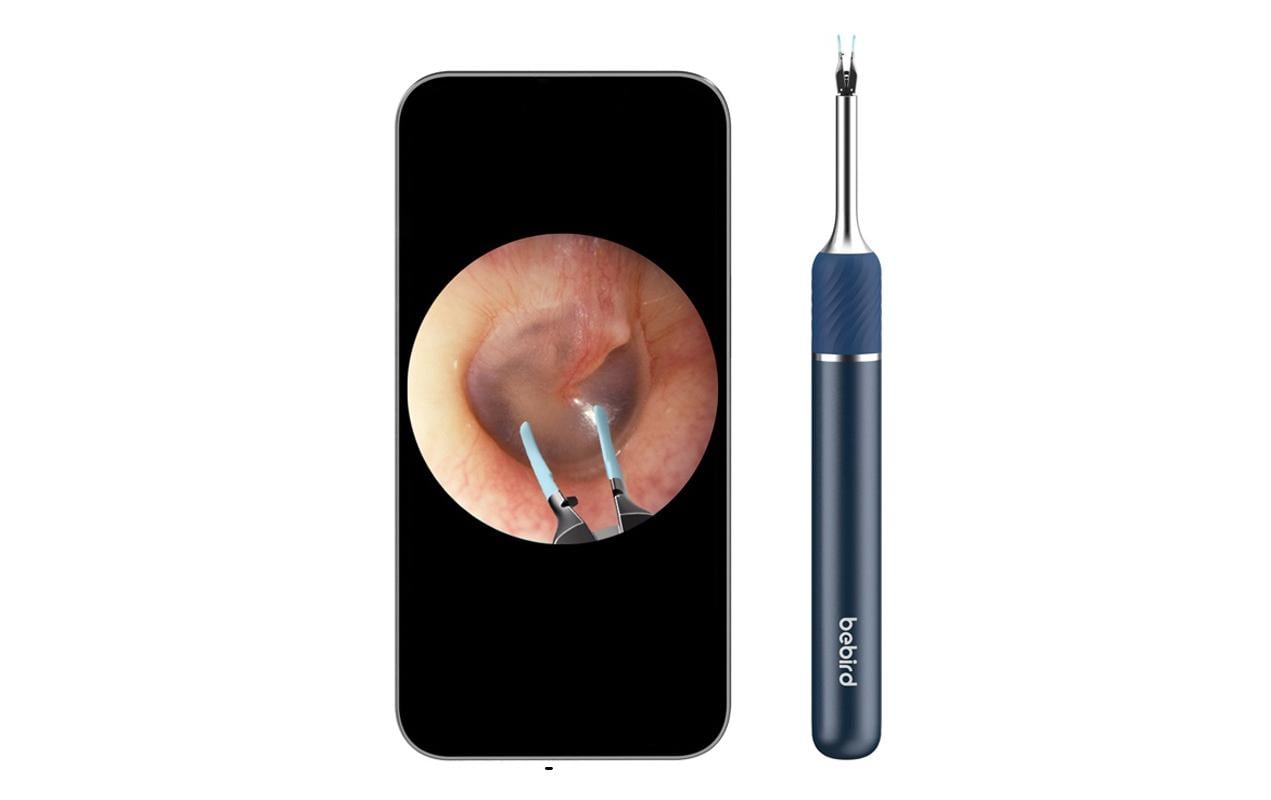 Ohrenreiniger Note 5 Pro Blau<br>Ohrenschmalzentferner mit Kamera
