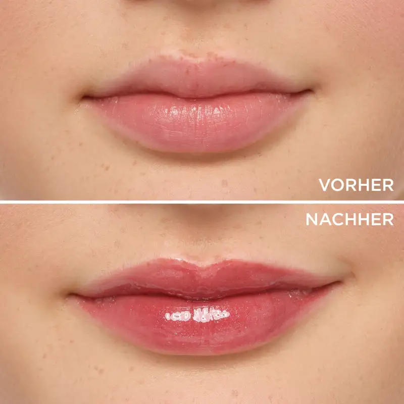 Lip Brilliance