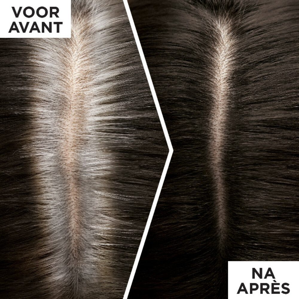 L'Oréal Magic Retouch Uitgroeispray Zwart75 ml
