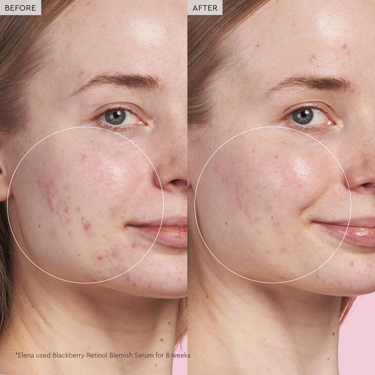 Glow Recipe Blackberry Retinol - Reset serum