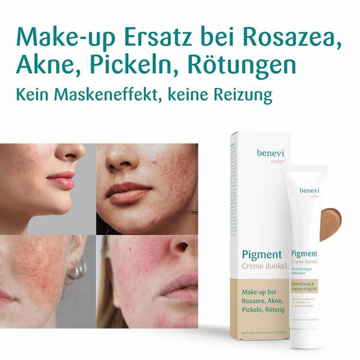 Benevi Color Pigmentcreme dunkel, 20 ml