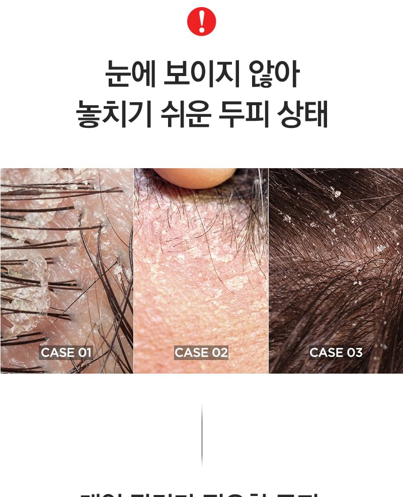 TOSOWOONG - Kelp Shampoo