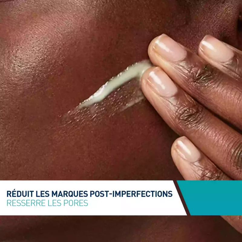Sérum Rétinol Anti-Marques enrichi au Rétinol encapsulé et aux 3 céramides essentiels - Cerave - 30ml