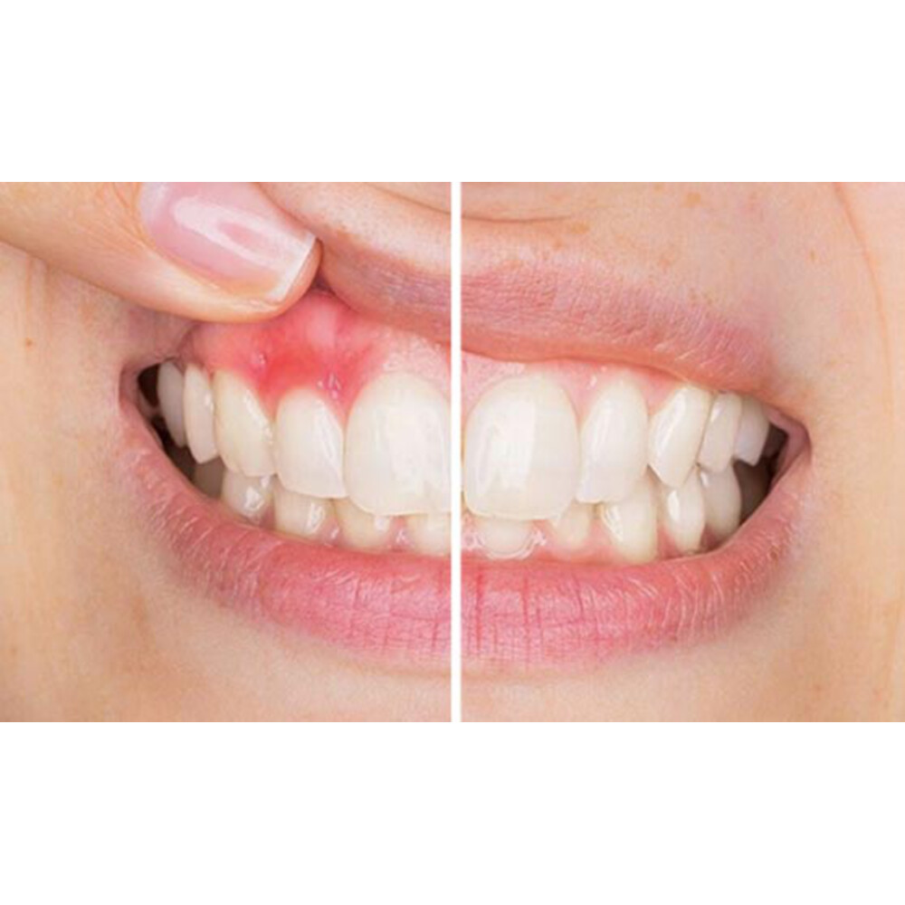 Sorefix Aften Plus Gel7 ml