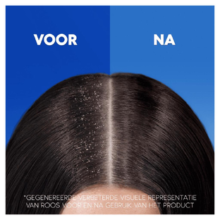 Head & Shoulders Jeukende Hoofdhuid Shampoo 285ML
