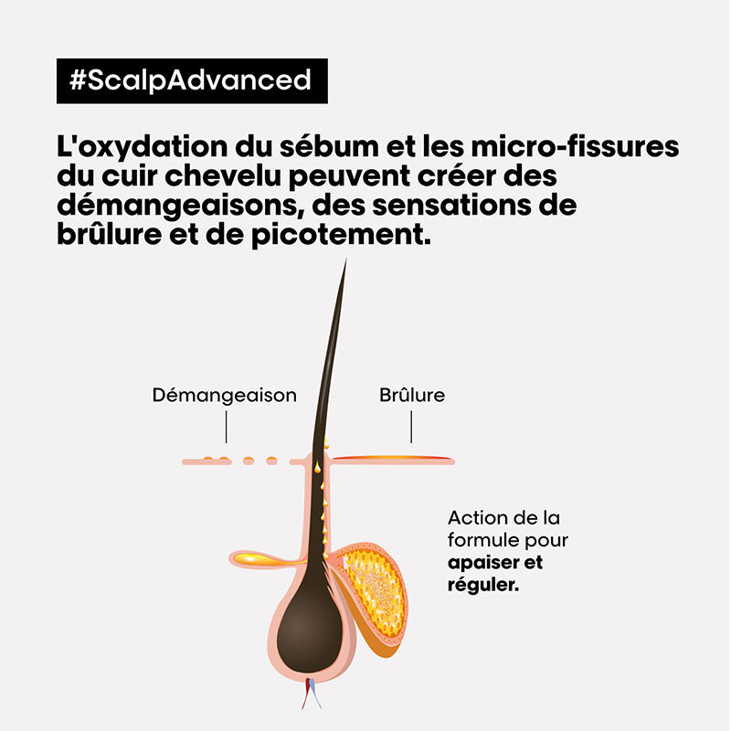 Shampooing dermo-régulateur anti-inconfort Scalp Advanced 300ml