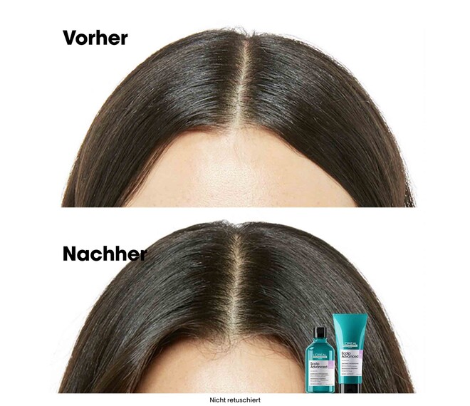 L'Oréal Professionnel Scalp Advanced Anti-Discomfort Shampoo