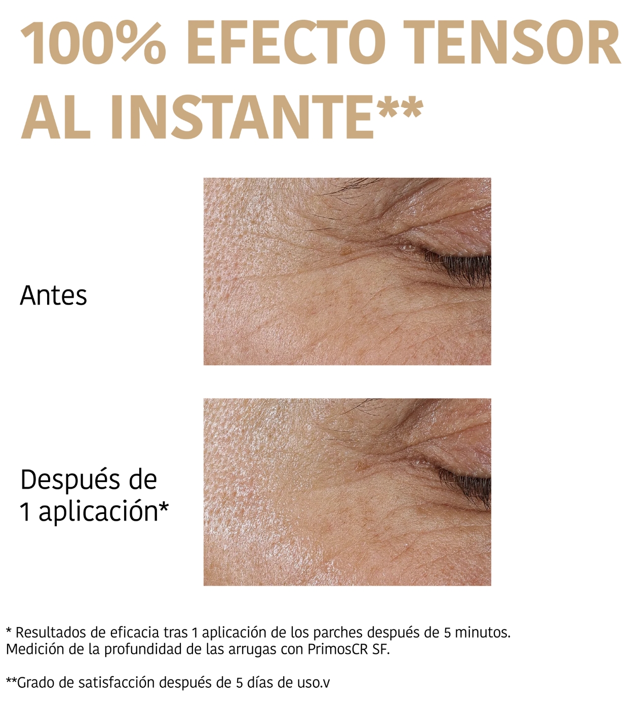 Iroha Nature - Adesivos para Contorno dos Olhos 99% Collagen Lifting Effect - 6 units