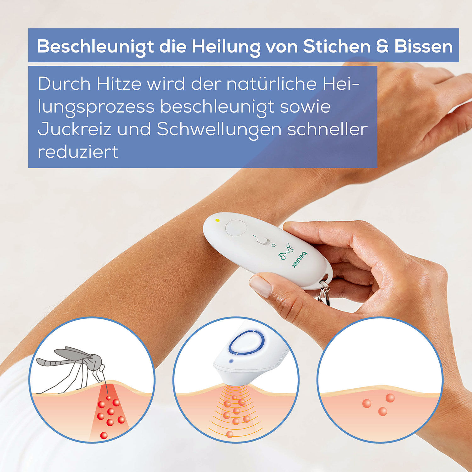 Beurer Insektenstichheiler
