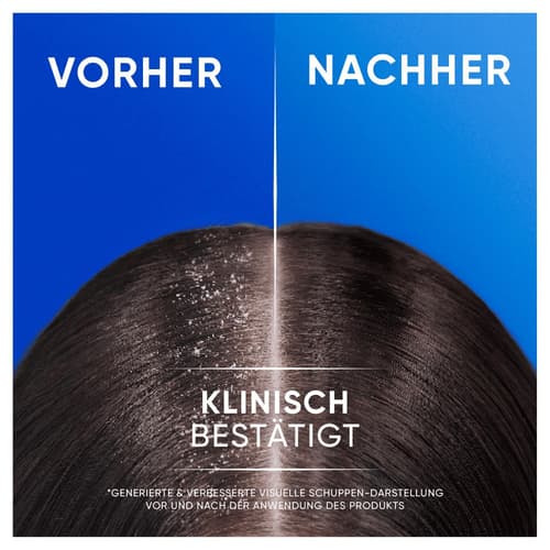 Head & Shoulders Apple Fresh 2in1 Anti-Schuppen-Shampoo