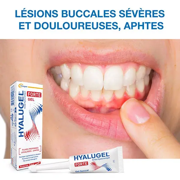 Hyalugel Forte Gel Oral 8ml