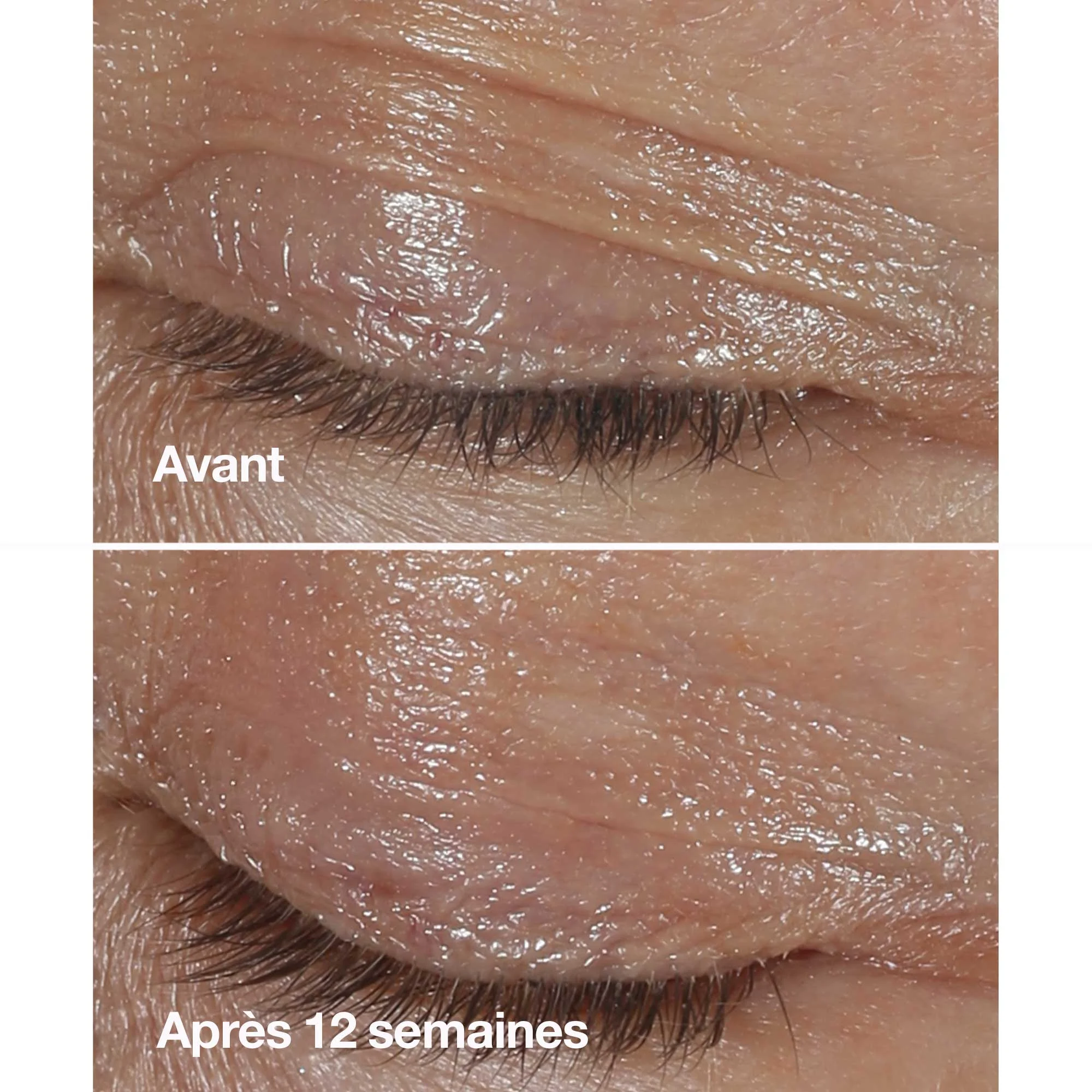 Smart Clinical Repair - Crème Yeux Correction Rides |