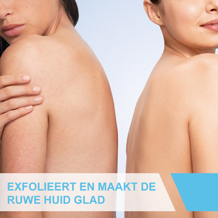 CeraVe SA Anti-ruwe Huidcrème 340GR
