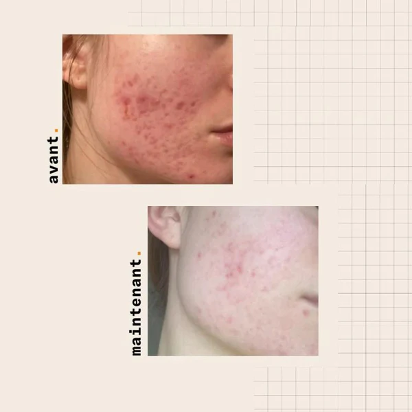 Skin and Out Even Out - Le Soin Ciblé Anti-tâche 30ml